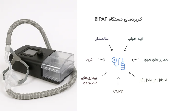 کاربردهای دستگاه بایپپ