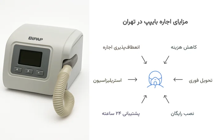 مزایای اجاره بایپپ در تهران از پارسان مد