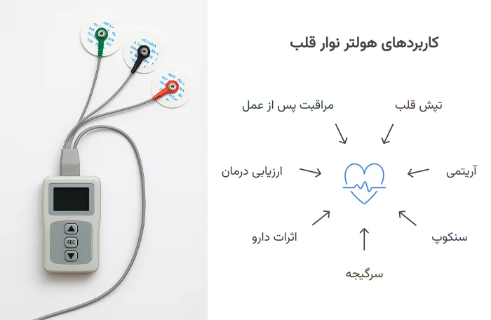 موارد استفاده هولتر نوار قلب