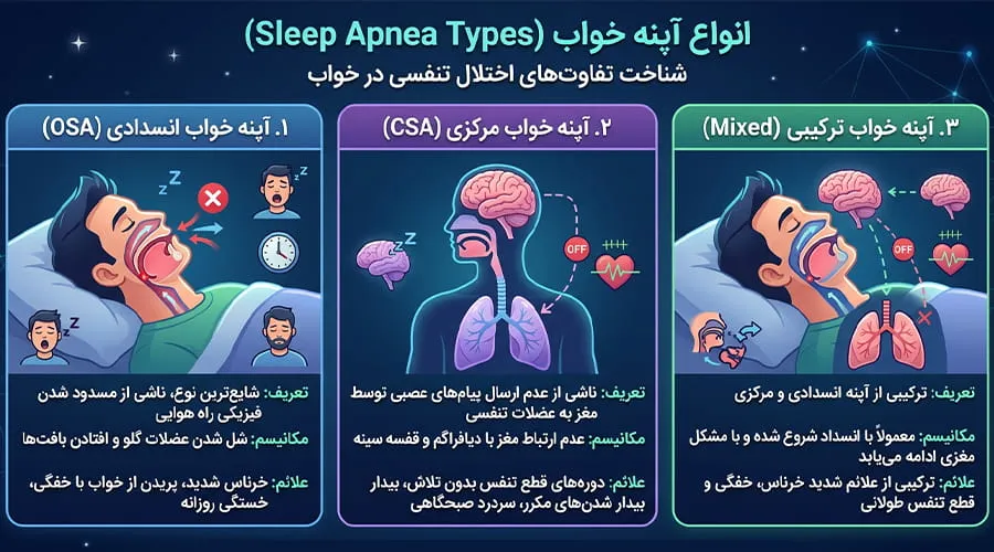 انواع آپنه خواب